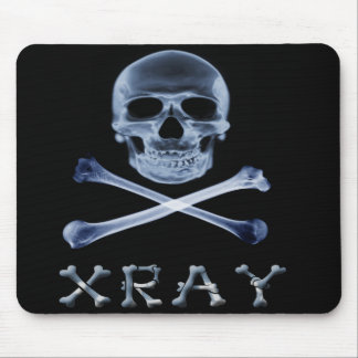 Tapis De Souris JOLLY ROGER de RADIOLOGIE de drapeau de PIRATE de