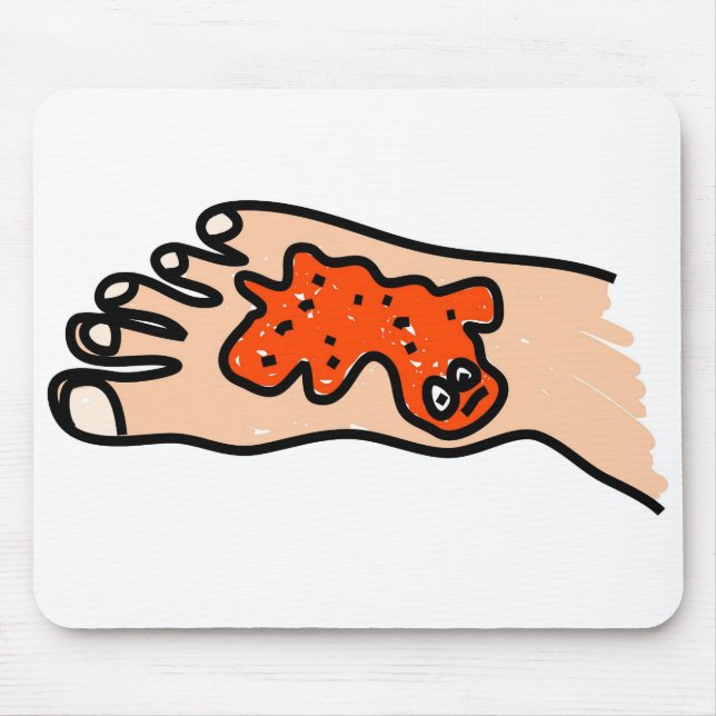 Tapis De Souris La maladie de pied (Devant)