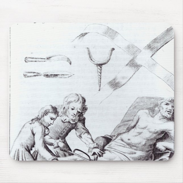 Tapis De Souris Opération chirurgicale pour amputer une jambe (Devant)