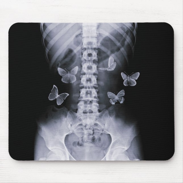 Tapis De Souris Papillons conceptuels Mousepad de rayon X (Devant)