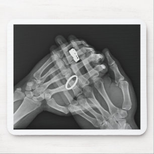 Tapis De Souris Participation de main