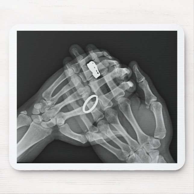 Tapis De Souris Participation de main (Devant)