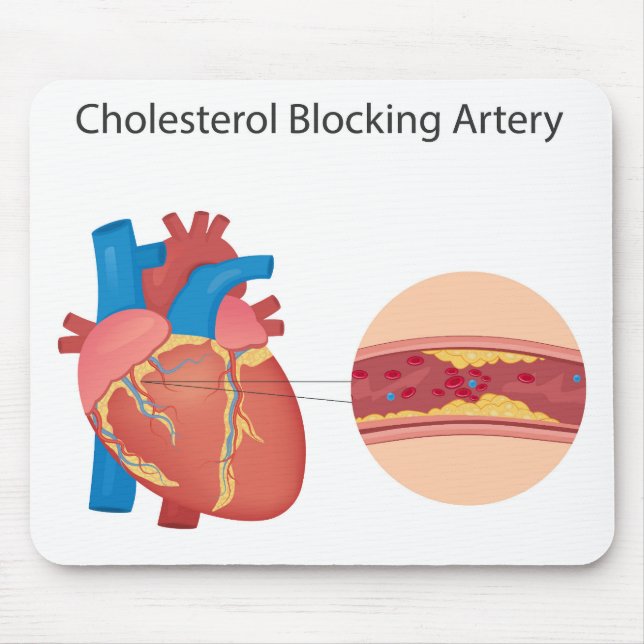 Tapis De Souris Vaisseaux sanguins étroits (Devant)