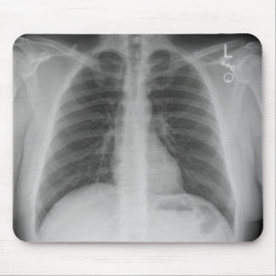 Tapis De Souris X-Ray Mousepad