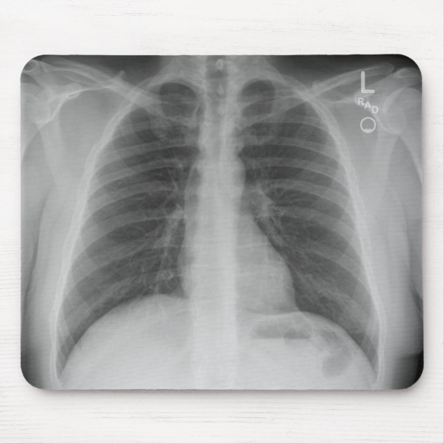 Tapis De Souris X-Ray Mousepad (Devant)