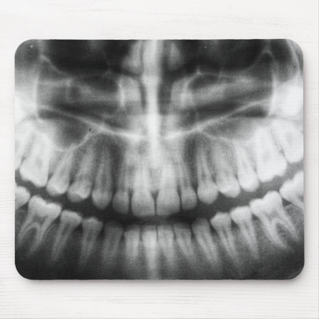 Tapis De Souris X-Ray Teeth Bouche sourire noir et blanc (Devant)
