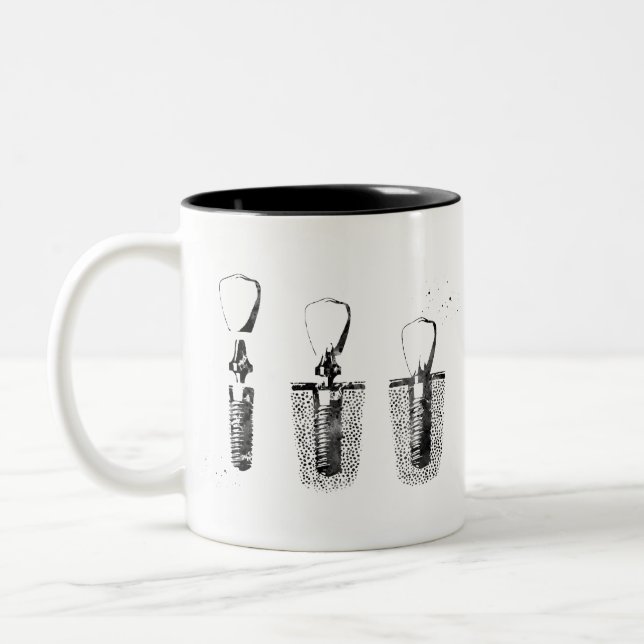 Tasse 2 Couleurs Procédure d'implant dentaire (Gauche)