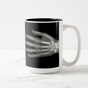 Tasse 2 Couleurs Radiographie de main squelette