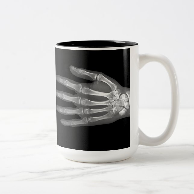 Tasse 2 Couleurs Radiographie de main squelette (Droit)