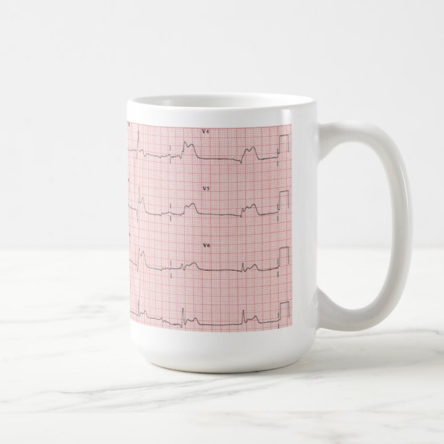 Tasse d'ECG (Droite)