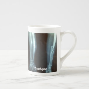 Tasse En Porcelaine Rayon cassé et Ulna Xray "Temps de pause"