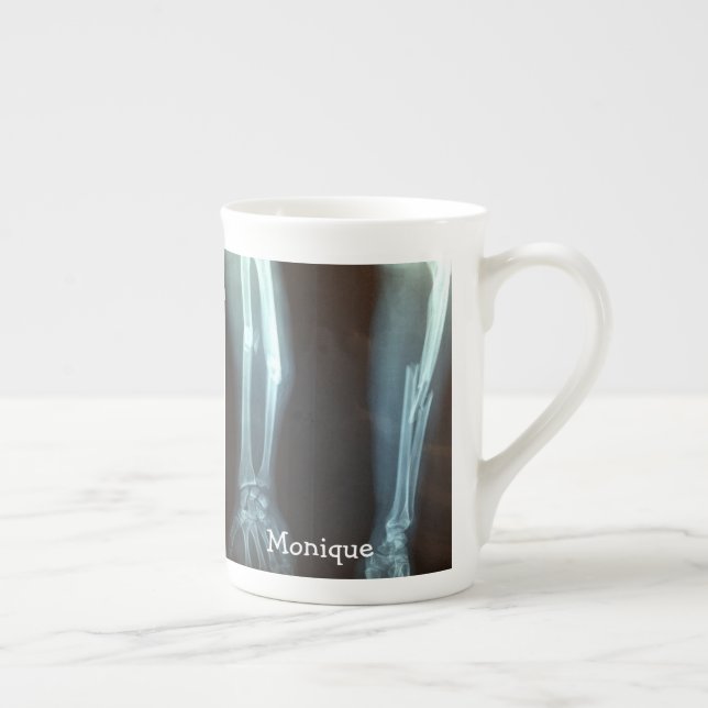 Tasse En Porcelaine Rayon cassé et Ulna Xray "Temps de pause" (Droite)