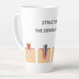 Tasse Latte Structure de l'implant dentaire