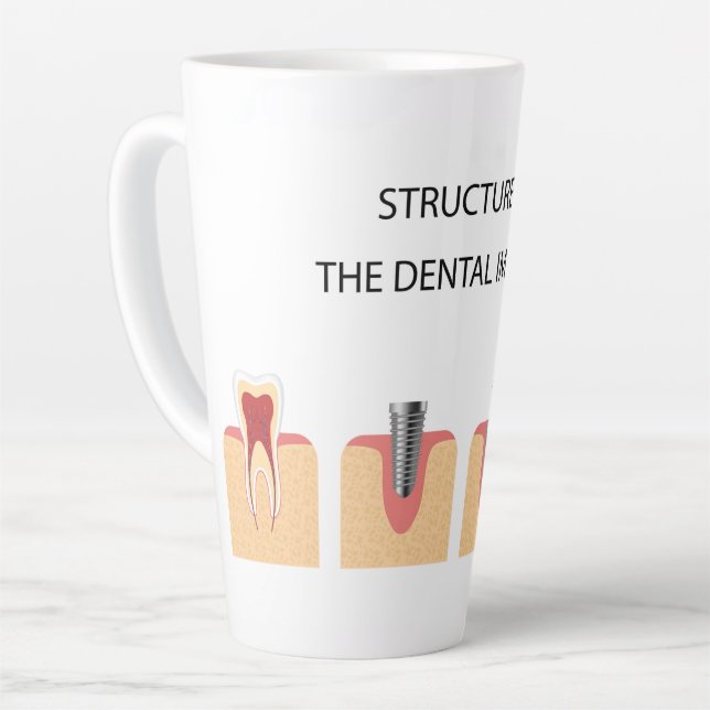 Tasse Latte Structure de l'implant dentaire (Angle gauche)