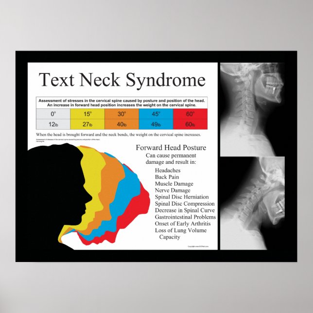 Texte Syndrome du cou Chiropratique Poster (Devant)