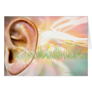 Tinnitus, illustration conceptuelle d'ordinateur.