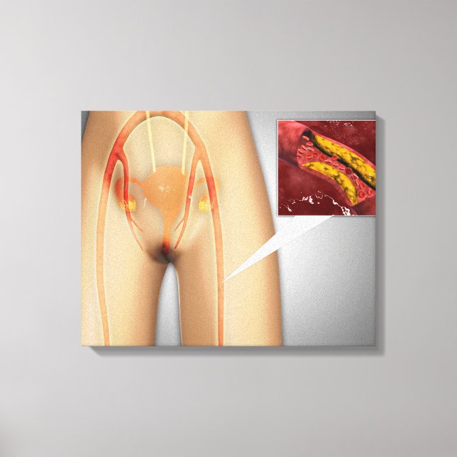 Toile Artère étroite près de la jambe Gros plan (Recto)