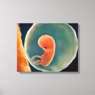 Toile Développement de foetus à 9 semaines