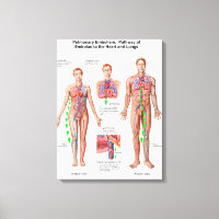 Embolisme Pulmonaire, Voie D'Embolus
