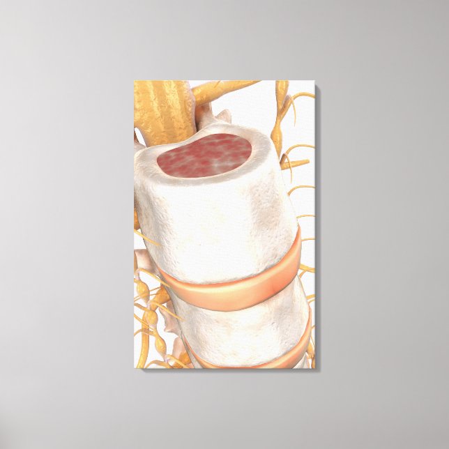 Toile Fermer un disque invertébral dans la colonne verté (Recto)