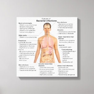 Toile Graphique des infections bactériennes chez l'homm