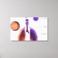 Illustration d'une crise d'asthme causée par le po