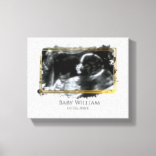 Toile Image de sonogramme Ultrasonique Baby Attente