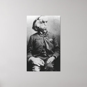 Toile Joseph "John" Merrick L'homme éléphant de 1889