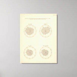 Toile Les 113 décès par le mois 1900