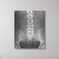 Toile numérique à rayons X enrobée