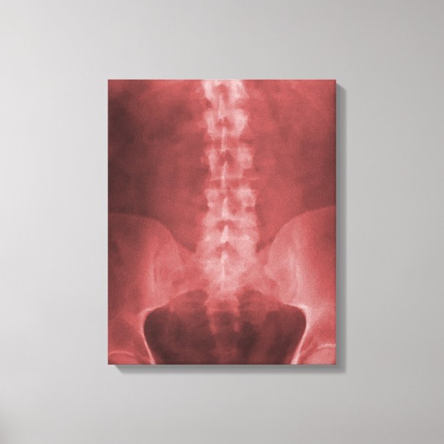 Toile numérique à rayons X enrobée (Recto)