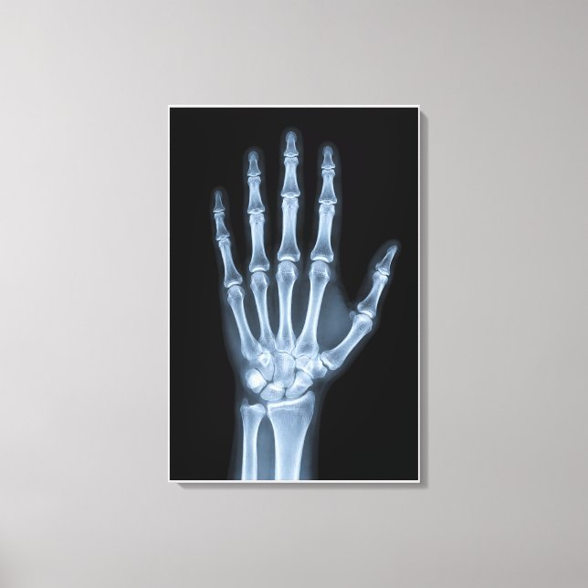 Toile Radiographie clinique de la main (Recto)