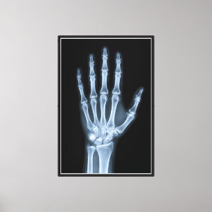 Toile Radiographie clinique de la main