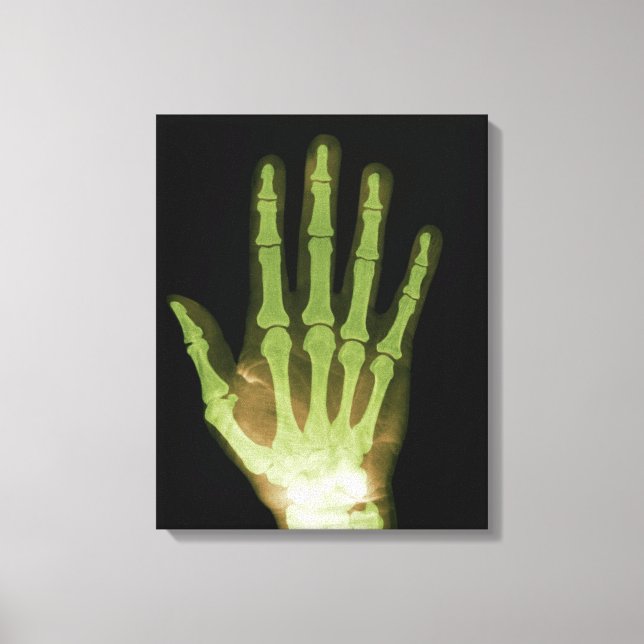 Toile Radiographie de la main humaine (Recto)