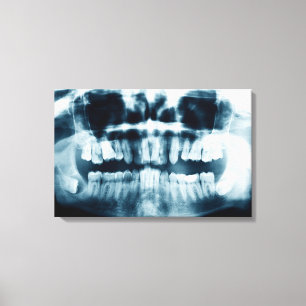 Toile Radiographie dentaire