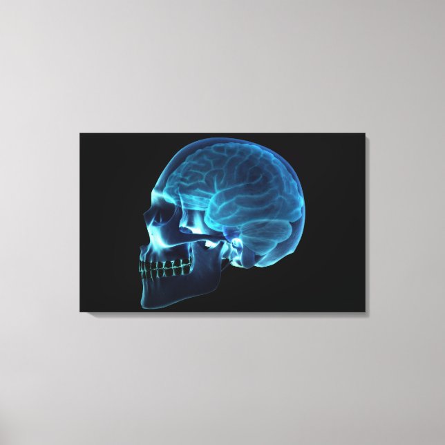 Toile Radiographie du cerveau à l'intérieur d'un crâne (Recto)
