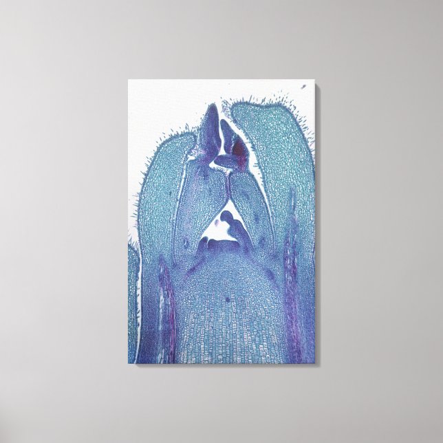 Toile Section longitudinale d'un bout de tige d'érable ( (Recto)