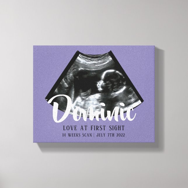 Toile Sonogramme Keepsaké Baby Ultrasound Canvas Imprime (Recto)
