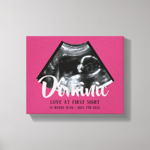 Toile Sonogramme Keepsaké Baby Ultrasound Canvas Imprime