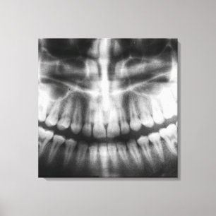 Toile Sourire noir et blanc de la bouche des dents de ra