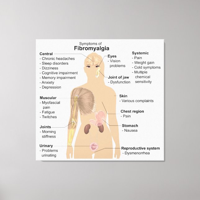 Toile Symptômes du graphique Fibromyalgie Tableaux impri (Recto)