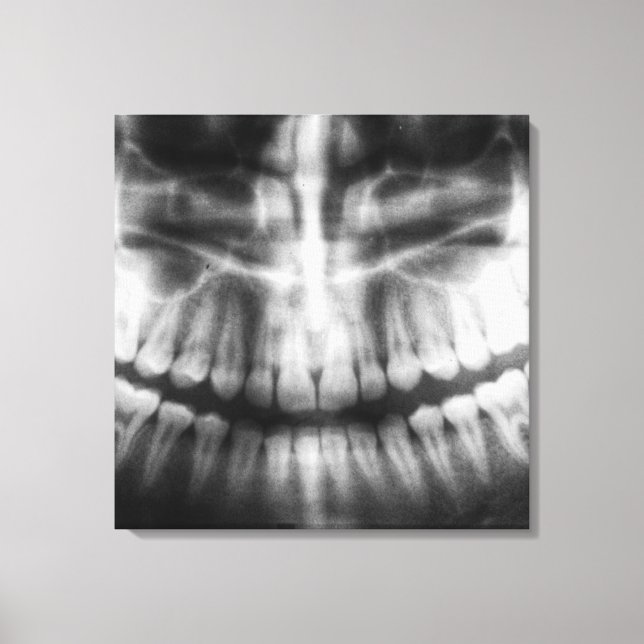 Toile X-Ray Teeth Bouche sourire noir et blanc (Recto)