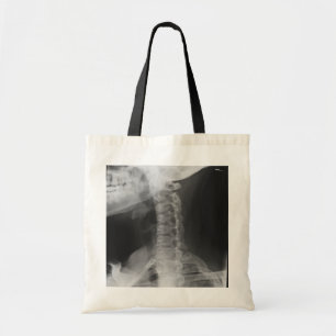 Tote Bag 2 radiographiés