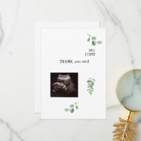 Ultrasound Merci blanc Baby Point de vue