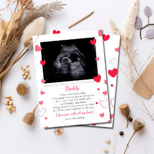 Valentines à papa de bosse
