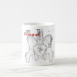 Vis obtenues ? Tasse